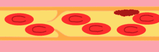 ʲôL(fng)